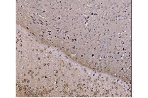 IHC analysis of JAB1 using anti-JAB1 antibody (ABIN7602482).