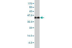 Image no. 1 for anti-Serpin Family H Member 1 (SERPINH1) (AA 1-419) antibody (ABIN465945)
