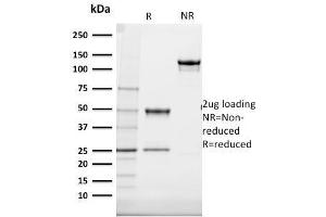 SDS-PAGE Analysis Purified Cytokeratin 20 (KRT20) Mouse Monoclonal Antibody (SPM140). (KRT20 抗体  (AA 196-323))