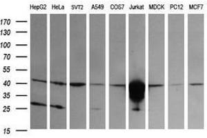 Image no. 2 for anti-T-cell surface glycoprotein CD1c (CD1C) antibody (ABIN1497192) (CD1c 抗体)