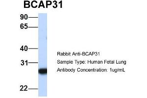 Host:  Rabbit  Target Name:  BCAP31  Sample Type:  Human Fetal Lung  Antibody Dilution:  1. (BCAP31 抗体  (Middle Region))