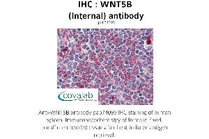 Image no. 3 for anti-Wingless-Type MMTV Integration Site Family, Member 5B (WNT5B) (Internal Region) antibody (ABIN1740832) (WNT5B 抗体  (Internal Region))