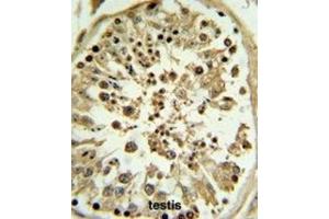 Immunohistochemistry (IHC) image for anti-Apolipoprotein L, 4 (APOL4) antibody (ABIN3002795) (Apolipoprotein L 4 抗体)