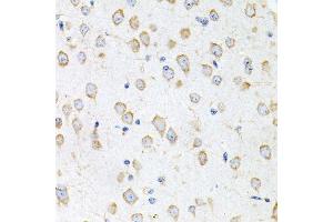 Immunohistochemistry of paraffin-embedded mouse brain using PROK2 antibody.