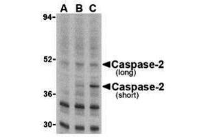 Immunohistochemistry (IHC) image for anti-Caspase 2, Apoptosis-Related Cysteine Peptidase (CASP2) (N-Term) antibody (ABIN1031296) (Caspase 2 抗体  (N-Term))
