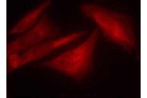Immunofluorescence staining of methanol-fixed HeLa cells using Phospho-G3BP1-S232 antibody (ABIN2988019).