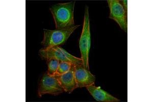 Immunofluorescence analysis of PANC-1 cells using TUBB3 mouse mAb (green). (TUBB3 抗体)