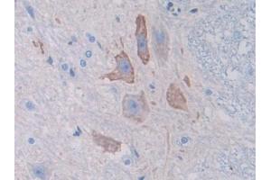 DAB staining on IHC-P; Samples: Rat Spinal cord Tissue