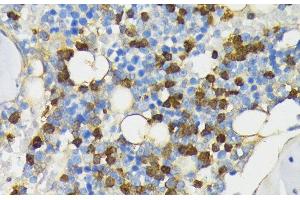 Immunohistochemistry of paraffin-embedded Rat bone marrow using CAMP Polyclonal Antibody at dilution of 1:200 (40x lens).