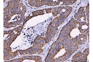 IHC analysis of MRPS18B using anti-MRPS18B antibody (ABIN7600740).