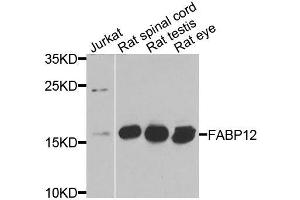 Western blot analysis of extracts of various cell lines, using FABP12 antibody (ABIN6003626) at 1/1000 dilution. (FABP12 抗体)