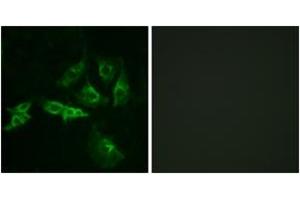 Immunofluorescence analysis of A549 cells, using GNRHR Antibody. (GNRHR 抗体  (AA 41-90))