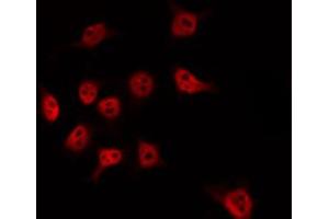 ABIN6274525 staining HT29 by IF/ICC. (MED17 抗体  (Internal Region))