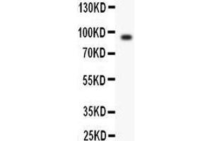 Anti- Periostin antibody, Western blotting All lanes: Anti Periostin  at 0. (Periostin 抗体  (N-Term))