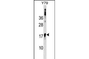 BCL7B Antibody (C-term) (ABIN1536707 and ABIN2848811) western blot analysis in Y79 cell line lysates (35 μg/lane). (BCL7B 抗体  (C-Term))