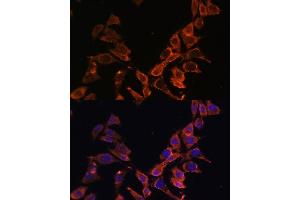 Immunofluorescence analysis of L929 cells using MT-ND4 antibody (ABIN7268602) at dilution of 1:100. (Mitochondrially Encoded NADH Dehydrogenase 4 (MT-ND4) 抗体)
