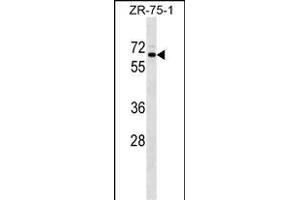 SRPR Antibody (C-term) (ABIN1537353 and ABIN2849199) western blot analysis in ZR-75-1 cell line lysates (35 μg/lane). (SRPR 抗体  (C-Term))