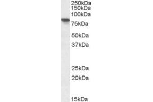 Western Blotting (WB) image for anti-X-Prolyl Aminopeptidase (Aminopeptidase P) 1, Soluble (XPNPEP1) (C-Term) antibody (ABIN2464155) (XPNPEP1 抗体  (C-Term))