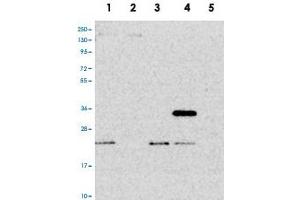 Western blot analysis of Lane 1: RT-4, Lane 2: U-251 MG, Lane 3: Human Plasma, Lane 4: Liver, Lane 5: Tonsil with PTCD2 polyclonal antibody . (PTCD2 抗体)