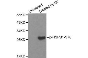 Western blot analysis of extracts from HL60 cells, using Phospho-HSPB1-S78 antibody. (HSP27 抗体  (pSer78))