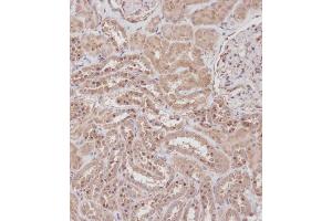 Immunohistochemical analysis of B on paraffin-embedded Human kidney tissue. (RPL23A 抗体  (C-Term))