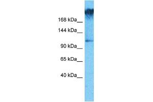 Host:  Rabbit  Target Name:  WDR7  Sample Type:  COLO205 Whole Cell lysates  Antibody Dilution:  1.