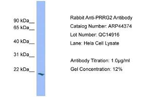 WB Suggested Anti-PRRG2  Antibody Titration: 0. (PRRG2 抗体  (Middle Region))