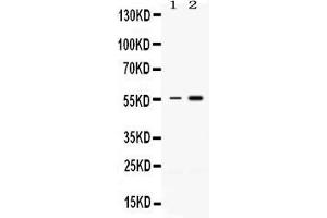 Western blot analysis of MEF2A expression in rat thymus extract ( Lane 1) and HELA whole cell lysates ( Lane 2). (MEF2A 抗体  (C-Term))