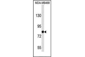 Western blot analysis of EVI5 Antibody (Center) in MDA-MB468 cell line lysates (35ug/lane). (EVI5 抗体  (Middle Region))
