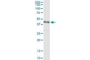 Immunoprecipitation of STK19 transfected lysate using anti-STK19 MaxPab rabbit polyclonal antibody and Protein A Magnetic Bead , and immunoblotted with STK19 purified MaxPab mouse polyclonal antibody (B01P) . (STK19 抗体  (AA 1-364))