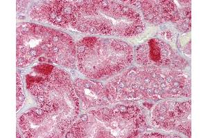 Immunohistochemistry (IHC) image for anti-alpha-Methylacyl-CoA Racemase (AMACR) (AA 286-335) antibody (ABIN6748648)