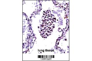 NFKBIB Antibody immunohistochemistry analysis in formalin fixed and paraffin embedded human lung tissue followed by peroxidase conjugation of the secondary antibody and DAB staining. (NFKBIB 抗体  (C-Term))