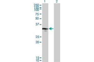 Western Blot analysis of CENPP expression in transfected 293T cell line by CENPP monoclonal antibody (M07), clone 3G8. (CENPP 抗体  (AA 1-98))