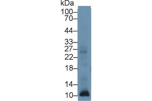 Western blot analysis of Human Leukocyte lysate, using Human S100A12 Antibody (1 µg/ml) and HRP-conjugated Goat Anti-Rabbit antibody (