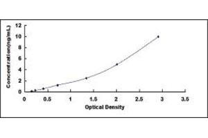 Typical standard curve (CPT1A ELISA 试剂盒)