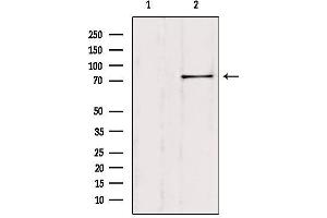 Western blot analysis of extracts from Hela, using SH2B1 Antibody. (SH2B1 抗体  (Internal Region))