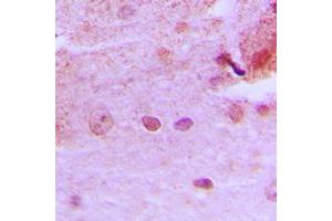 Immunohistochemical analysis of PMS1 staining in human brain formalin fixed paraffin embedded tissue section. (PMS1 抗体  (Center))