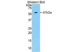 Western Blotting (WB) image for anti-Hexokinase 2 (HK2) (AA 605-868) antibody (ABIN3204499) (Hexokinase 2 抗体  (AA 605-868))
