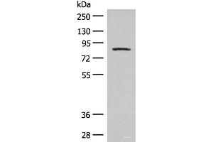 Western blot analysis of Mouse brain tissue lysate using PFKM Polyclonal Antibody at dilution of 1:350 (PFKM 抗体)