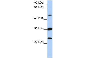 WB Suggested Anti-XK Antibody Titration:  0. (Membrane transport protein XK (XK) (N-Term) 抗体)