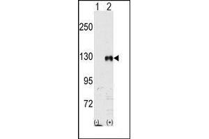 Western blot analysis of EphB1 (arrow) using rabbit polyclonal EphB1 Antibody. (EPH Receptor B1 抗体)