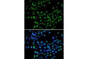 Immunofluorescence analysis of A549 cells using EAF2 antibody (ABIN5974281). (EAF2 抗体)