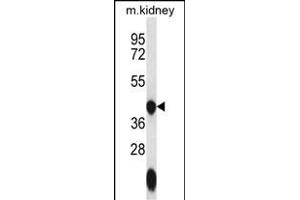GTPBP10 Antibody (C-term) (ABIN656643 and ABIN2845886) western blot analysis in mouse kidney tissue lysates (35 μg/lane). (GTPBP10 抗体  (C-Term))