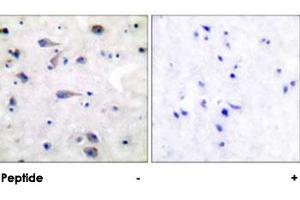 Immunohistochemical analysis of paraffin-embedded human brain tissue using OPRM1 polyclonal antibody . (Mu Opioid Receptor 1 抗体)