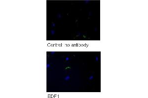 WB Suggested Anti-GPD1 Antibody    Titration: 5 ug/ml   Positive Control: HG (EDF1 抗体  (N-Term))
