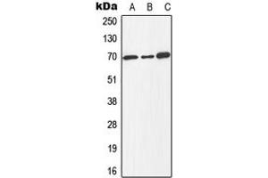 Western blot analysis of E2F1 (pT433) expression in Jurkat colchicine-treated (A), mouse spleen (B), PC12 colchicine-treated (C) whole cell lysates. (E2F1 抗体  (C-Term, pSer433))