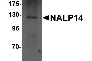 Western blot analysis of NALP14 in rat brain tissue lysate with NALP14 antibody at 1 µg/mL. (NLRP14 抗体  (N-Term))