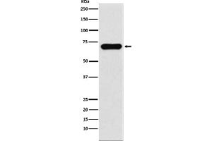 Western blot analysis of PCK1 expression in Human fetal kidney lysate.