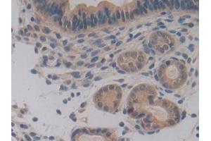 Immunohistochemistry (IHC) image for anti-Pyruvate Dehydrogenase Complex, Component X (PDHX) (AA 222-471) antibody (ABIN7443338)