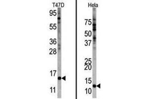 Image no. 1 for anti-Finkel-Biskis-Reilly Murine Sarcoma Virus (FBR-MuSV) Ubiquitously Expressed (FAU) (Center) antibody (ABIN357137) (FAU 抗体  (Center))